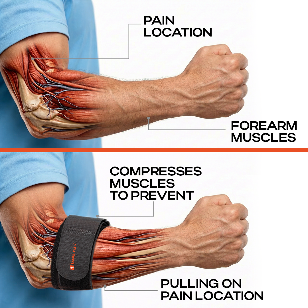 Tennis Elbow Support | 1 Unit | Universal | Unisex